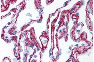 Human Lung (formalin-fixed, paraffin-embedded) stained with Collagen VI antibody ABIN364508 at 2. (COL6 抗体)