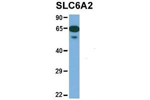 Western Blotting (WB) image for anti-Solute Carrier Family 6 (Neurotransmitter Transporter, Noradrenalin), Member 2 (SLC6A2) (Middle Region) antibody (ABIN2777051)