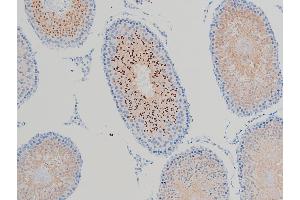 Immunohistochemistry (IHC) image for anti-Cofilin 1 (CFL1) (pSer3) antibody (ABIN6255180)