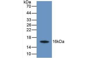 Detection of Recombinant TMEM27, Human using Monoclonal Antibody to Transmembrane Protein 27 (TMEM27) (TMEM27 抗体  (AA 17-137))