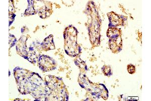 Formalin-fixed and paraffin embedded human placenta labeled with Rabbit Anti-KCNK3 Polyclonal Antibody, Unconjugated (ABIN682333) at 1:200 followed by conjugation to the secondary antibody and DAB staining (KCNK3 抗体  (AA 181-280))