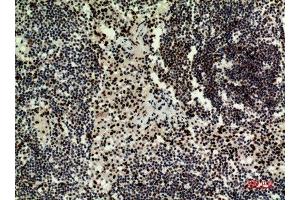 Immunohistochemistry (IHC) analysis of paraffin-embedded Human Lymph Nodes, antibody was diluted at 1:100. (HDGFRP3 抗体  (Internal Region))