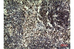 Immunohistochemistry (IHC) analysis of paraffin-embedded Human Lymph Nodes, antibody was diluted at 1:100.