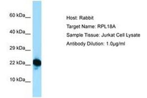 Image no. 1 for anti-Ribosomal Protein L18a (RPL18A) (C-Term) antibody (ABIN6749890) (RPL18A 抗体  (C-Term))
