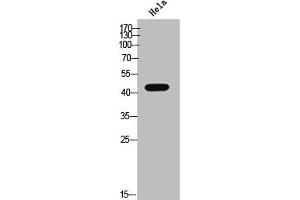 Western Blot analysis of HeLa cells using Phospho-Casein Kinase IIα (Y255) Polyclonal Antibody (CSNK2A1/CK II alpha 抗体  (pTyr255))
