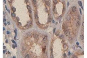 Immunohistochemical staining of formalin-fixed paraffin-embedded human fetal kidney tissue with PDGFC polyclonal antibody  at 1 : 100 dilution.