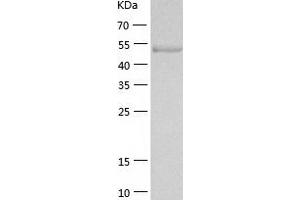 Western Blotting (WB) image for Muscle, Skeletal, Receptor Tyrosine Kinase (MUSK) (AA 22-468) protein (His tag) (ABIN7287553) (MUSK Protein (AA 22-468) (His tag))