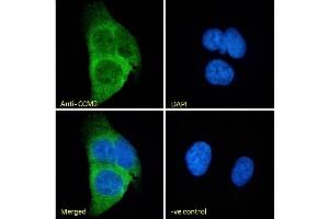 Immunofluorescence (IF) image for anti-Cerebral Cavernous Malformation 2 (CCM2) (Internal Region) antibody (ABIN185733)