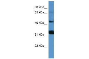 WB Suggested Anti-MFI2 Antibody Titration: 0. (MFI2 抗体  (C-Term))