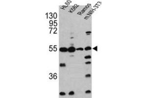 Western Blotting (WB) image for anti-Caspase 2, Apoptosis-Related Cysteine Peptidase (CASP2) antibody (ABIN2997249) (Caspase 2 抗体)