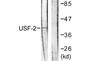 Western blot analysis of extracts from HeLa cells, using USF2 antibody. (USF2 抗体  (Internal Region))