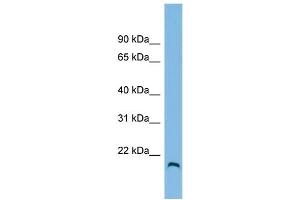 WB Suggested Anti-HFE2 Antibody Titration: 0. (HFE2 抗体  (N-Term))
