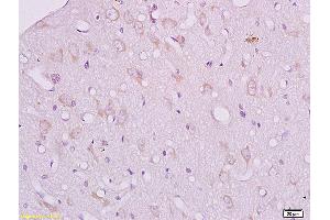 Immunohistochemistry (IHC) image for anti-Corticotropin Releasing Hormone Receptor 2 (CRHR2) (AA 51-150) antibody (ABIN680773)