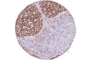 anti-Myxovirus Resistance Protein 1 (MX1) antibody