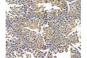 ABIN7096873 and ABIN7100939 at 1/100 staining mouse testis tissue by IHC-P.