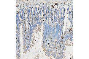 IHC analysis of COPE using anti-COPE antibody (ABIN7602509).