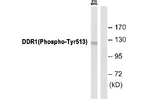 Western blot analysis of extracts from 3T3 cells, using DDR1 (Phospho-Tyr513) Antibody. (DDR1 抗体  (pTyr513))