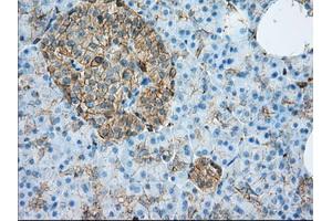 Immunohistochemical staining of paraffin-embedded liver tissue using anti-ALDH3A1 mouse monoclonal antibody.