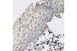 Immunohistochemistry of paraffin-embedded human esophagus using GBF1 antibody. (GBF1 抗体)