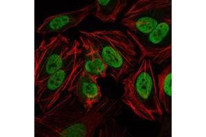 Immunofluorescence analysis of Hela cells using PRKDC mouse mAb (green). (PRKDC 抗体)