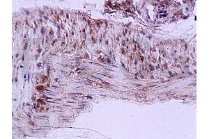 Formalin-fixed and paraffin embedded rat colon tissue labeled with Anti-Cygb Polyclonal Antibody (ABIN670566), Unconjugated at 1:200, followed by conjugation to the secondary antibody and DAB staining (CYGB 抗体  (AA 87-132))