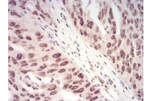 Immunohistochemistry (IHC) image for anti-Chromobox Homolog 1 (CBX1) (AA 1-185) antibody (ABIN5542477)