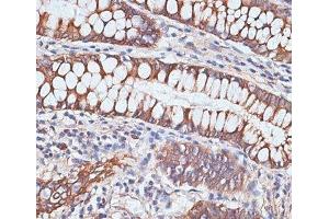 Immunohistochemistry of paraffin-embedded Human colon using PIGR Polyclonal Antibody at dilution of 1:100 (40x lens). (PIGR 抗体)