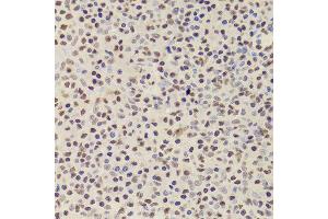 Immunohistochemistry of paraffin-embedded Human amygdalitis using ANP32A antibody at dilution of 1:100 (x400 lens). (PHAP1 抗体)