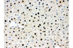 Immunohistochemistry (Paraffin-embedded Sections) (IHC (p)) image for anti-Retinoblastoma Binding Protein 4 (RBBP4) (AA 395-425), (C-Term) antibody (ABIN3043920) (Retinoblastoma Binding Protein 4 抗体  (C-Term))
