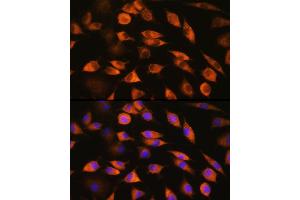 Immunofluorescence (IF) image for anti-Cytochrome P450, Family 51, Subfamily A, Polypeptide 1 (CYP51A1) (AA 210-509) antibody (ABIN6139370)