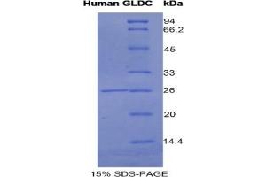SDS-PAGE of Protein Standard from the Kit (Highly purified E. (GLDC ELISA 试剂盒)