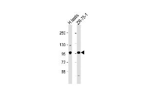 All lanes : Anti-STK31 Antibody (C-term) at 1:1000 dilution Lane 1: human testis lysate Lane 2: ZR-75-1 whole cell lysate Lysates/proteins at 20 μg per lane. (STK31 抗体  (C-Term))
