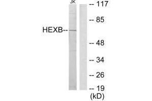 Western blot analysis of extracts from Jurkat cells, using HEXB antibody. (HEXB 抗体  (C-Term))