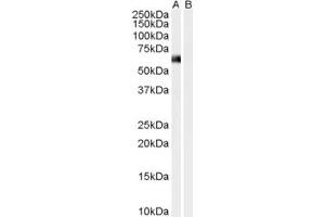 Image no. 1 for anti-Syntrophin, alpha 1 (Dystrophin-Associated Protein A1, 59kDa, Acidic Component) (SNTA1) (N-Term) antibody (ABIN185131)