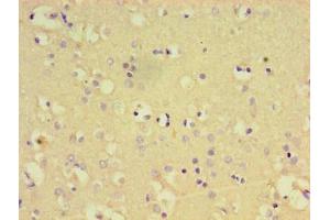 Immunohistochemistry of paraffin-embedded human brain tissue using ABIN7174112 at dilution of 1:100 (PTPN5 抗体  (AA 300-555))