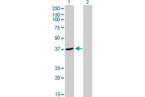 Western Blot analysis of ADH4 expression in transfected 293T cell line by ADH4 monoclonal antibody (M01), clone 3C5. (ADH4 抗体  (AA 52-150))