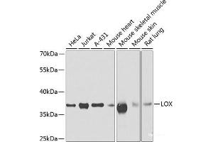 Western blot analysis of extracts of various cell lines using LOX Polyclonal Antibody at dilution of 1:500. (LOX 抗体)