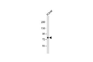 Anti-PCCA Antibody (Center) at 1:2000 dilution + human liver lysate Lysates/proteins at 20 μg per lane. (PCCA 抗体  (AA 362-390))