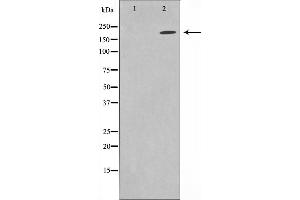 Western blot analysis on HuvEc cell lysate using Sodium Channel-pan Antibody,The lane on the left is treated with the antigen-specific peptide. (Sodium Channel-Pan 抗体)