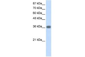 WB Suggested Anti-KLHDC8A Antibody Titration:  1. (KLHDC8A 抗体  (C-Term))