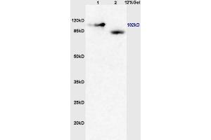 Lane 1: mouse brain lysates Lane 2: human colon carcinoma lysates probed with Anti GRM4/mGluR4 Polyclonal Antibody, Unconjugated (ABIN735998) at 1:200 in 4 °C. (GRM4/6 抗体  (AA 301-400))
