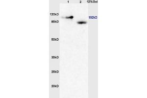Lane 1: mouse brain lysates Lane 2: human colon carcinoma lysates probed with Anti GRM4/mGluR4 Polyclonal Antibody, Unconjugated (ABIN735998) at 1:200 in 4 °C.