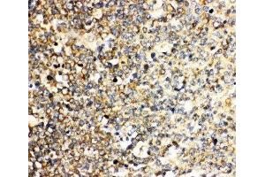 Anti-IL3 antibody, IHC(P) IHC(P): Human Tonsil Tissue (IL-3 抗体  (N-Term))