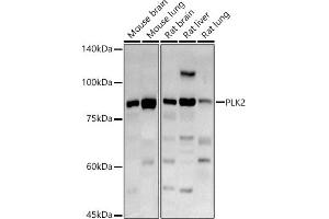 Western blot analysis of extracts of various cell lines, using PLK2 antibody (ABIN6132905, ABIN6145776, ABIN6145778 and ABIN6222860) at 1:1000 dilution. (PLK2 抗体  (AA 322-671))