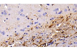 Immunohistochemistry (IHC) image for anti-Glial Fibrillary Acidic Protein (GFAP) (AA 253-354) antibody (ABIN7430747)