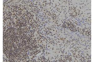 ABIN6260184 and ABIN6278307 at 1/100 staining Human spleen tissue by IHC-P.