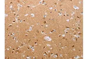The image on the left is immunohistochemistry of paraffin-embedded Human brain tissue using ABIN7191852(PFN2 Antibody) at dilution 1/30, on the right is treated with synthetic peptide. (PFN2 抗体)