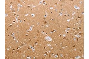 The image on the left is immunohistochemistry of paraffin-embedded Human brain tissue using ABIN7191852(PFN2 Antibody) at dilution 1/30, on the right is treated with synthetic peptide.
