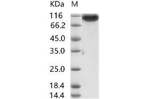 MERS-Coronavirus Spike Protein (MERS-CoV S) (Active) protein (His tag)