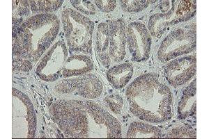 Immunohistochemistry (IHC) image for anti-ATP/GTP Binding Protein 1 (AGTPBP1) (AA 368-753) antibody (ABIN1491460)